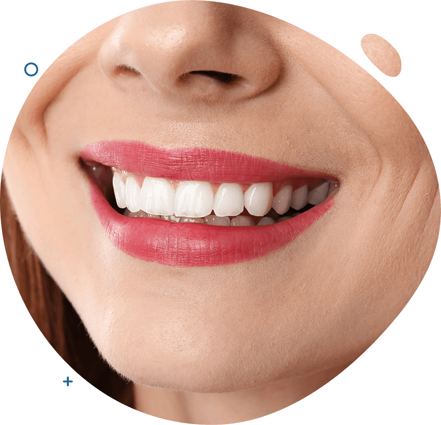 https://www.dentienonsolo.it/wp-content/uploads/2020/03/img-service.png